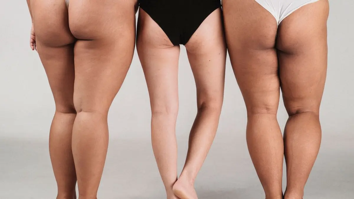 Hoe cellulite verminderen zonder in valse beloftes te trappen